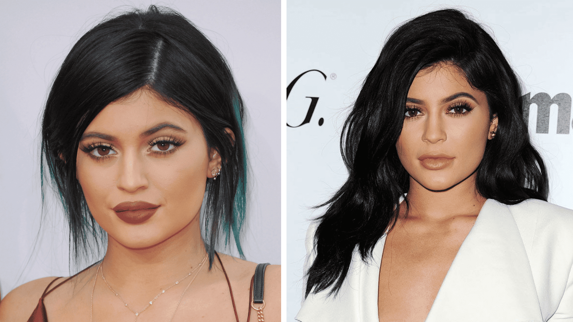 Lip-Filler