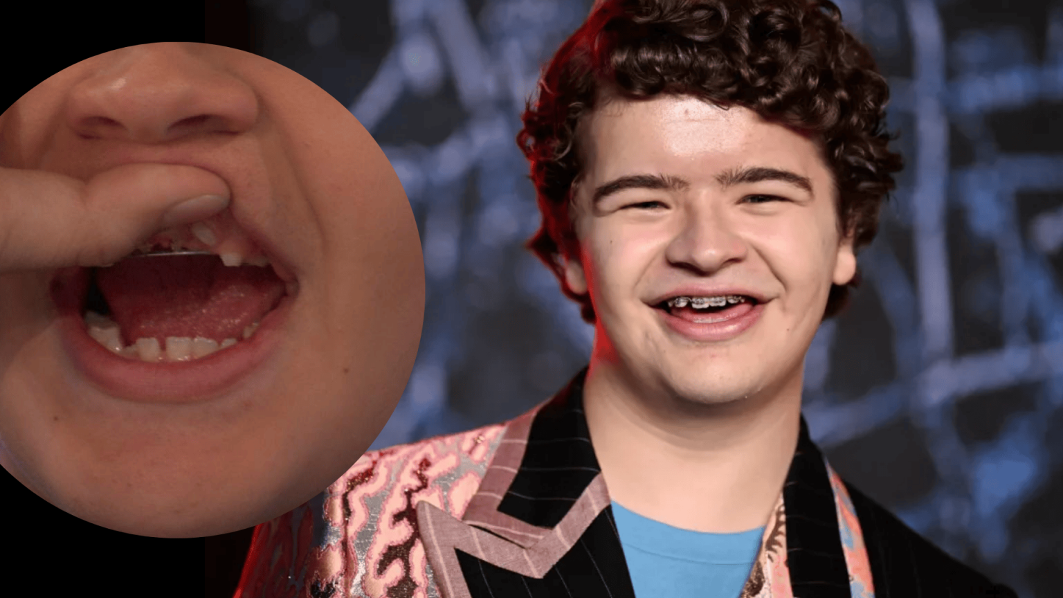 Gaten Matarazzo’s Journey with CCD - Concord p2c