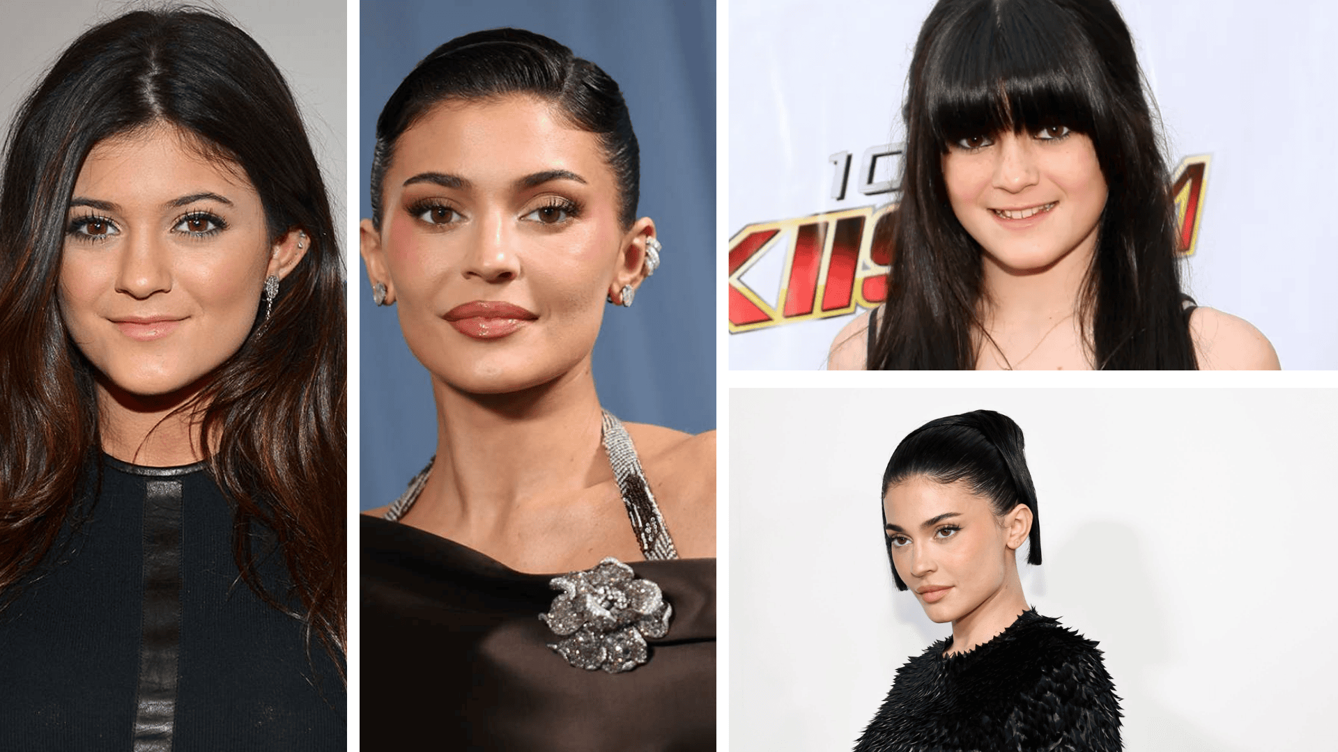 kylie jenner surgery