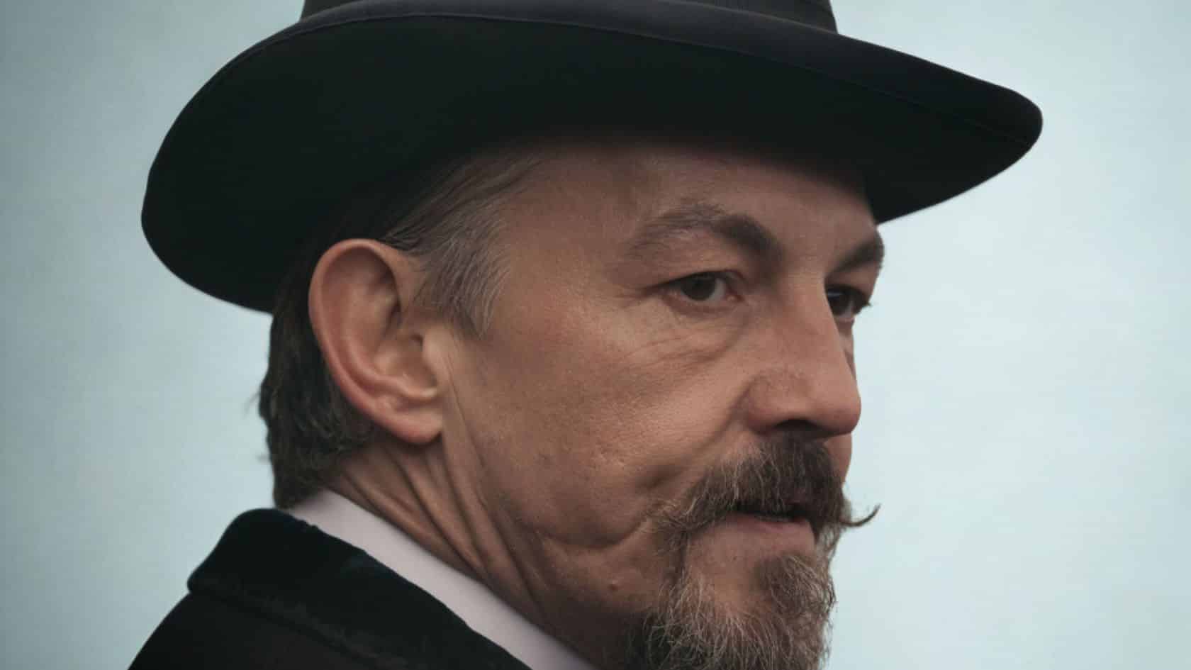 how did the guy from sons of anarchy get the scars on his face