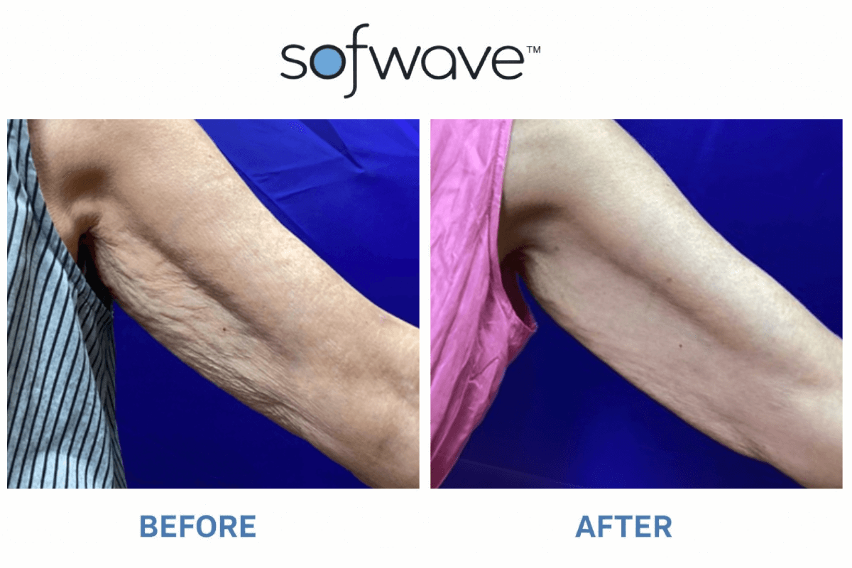 how expensive is semaglutide Weight Loss Drugs Price Ozempic Wegovy Zepbound how expensive is semaglutide Weight Loss Drugs Price Ozempic Wegovy Zepbound