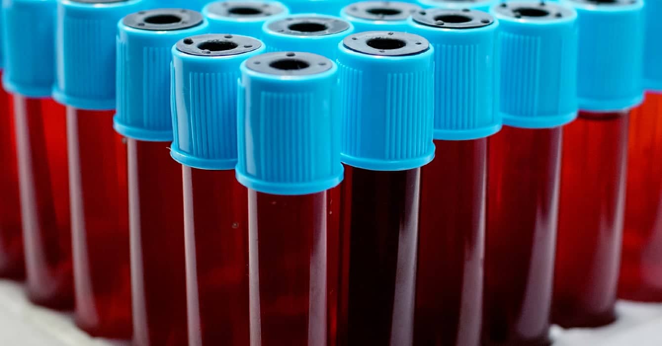 Test sample tubes with blue caps.