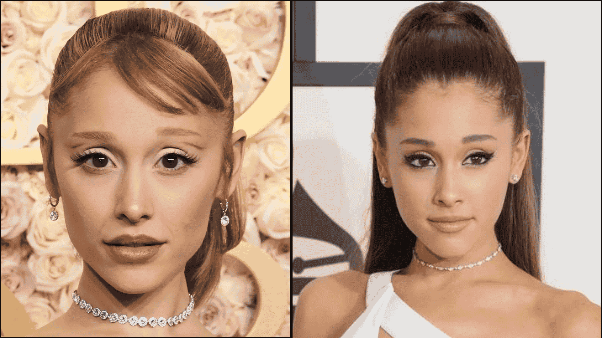 Ariana Grande before and after blepharoplasty comparison with more open and defined eyelids