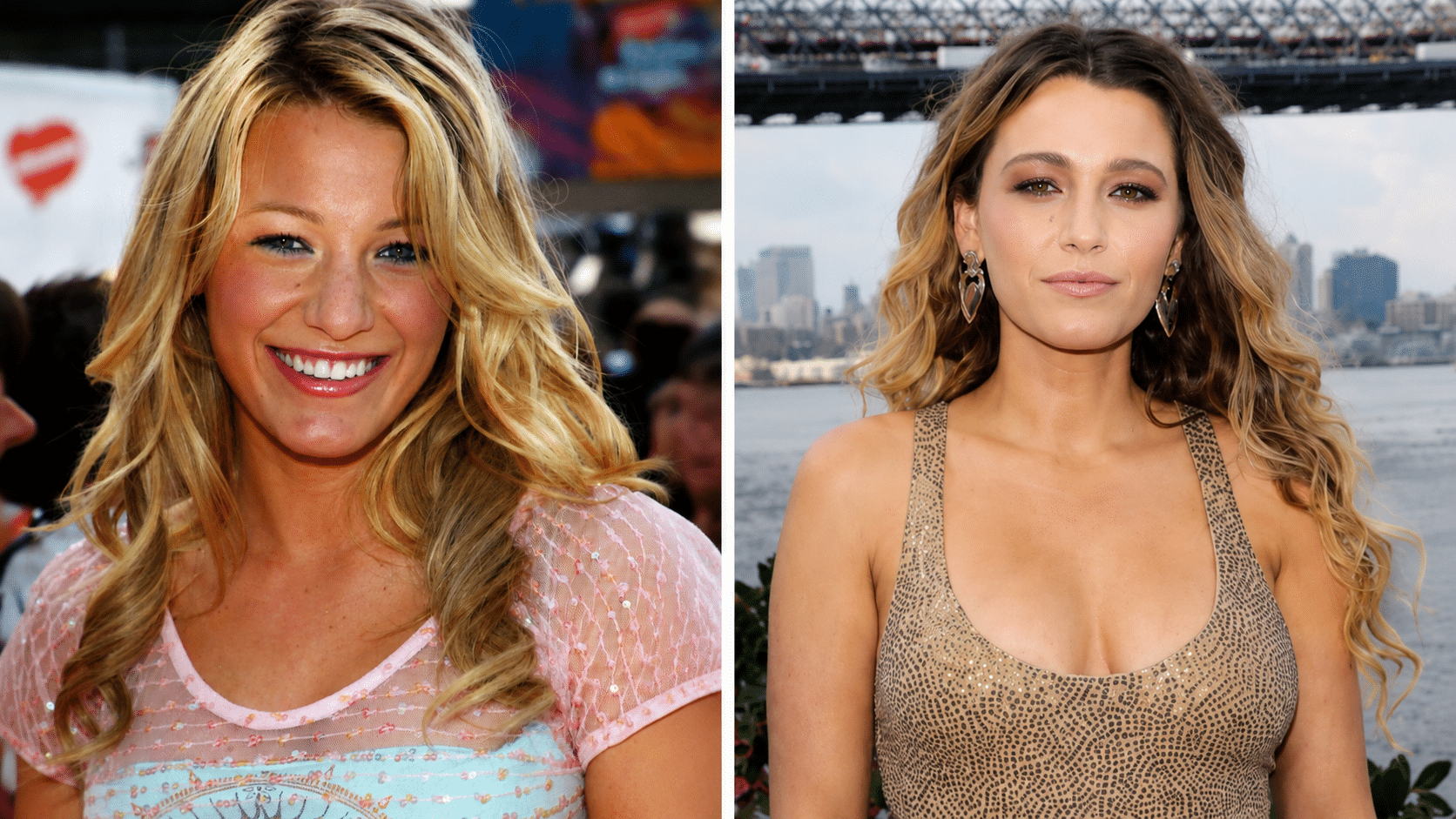 Blake Lively lip comparison showing enhanced upper lip definition and improved facial balance over time