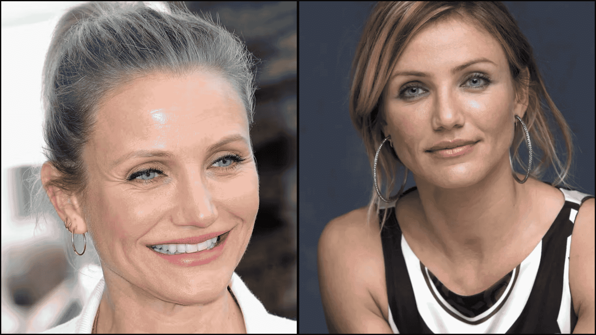 Cameron Diaz before and after blepharoplasty comparison highlighting lifted upper eyelids