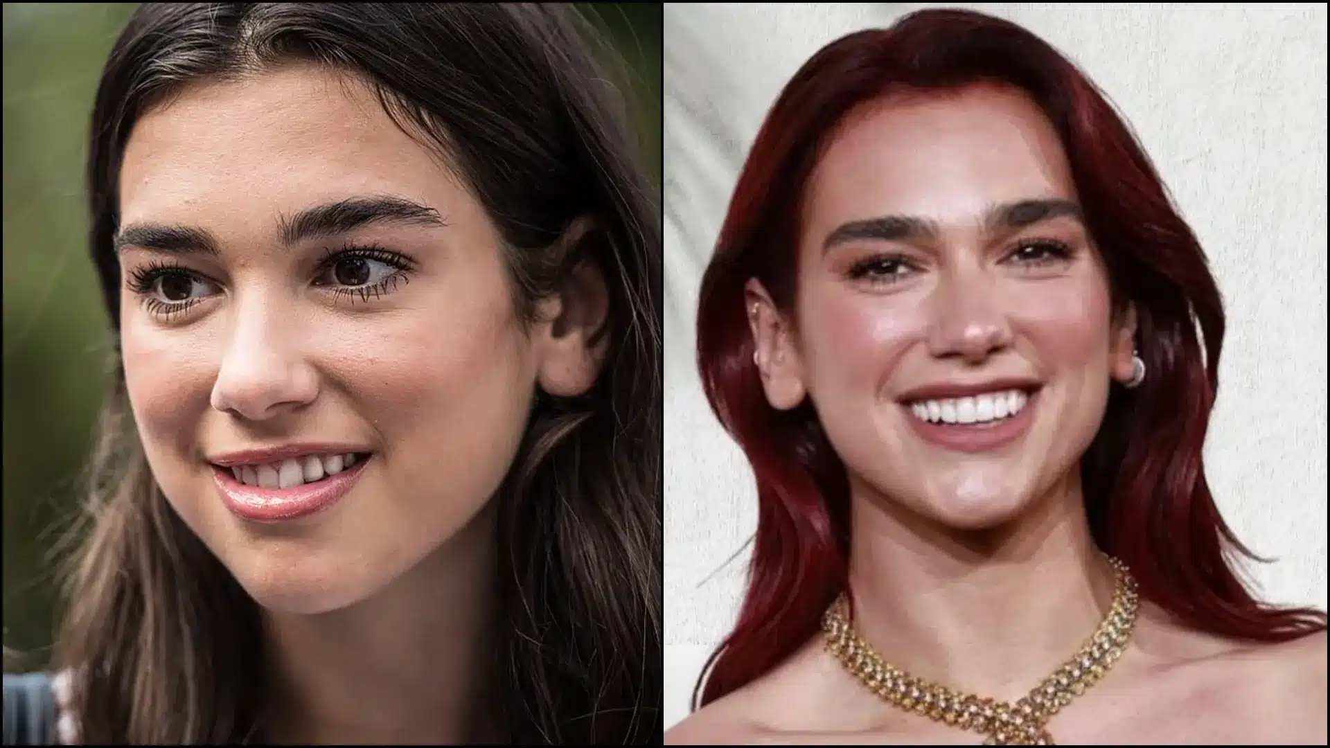ide-by-side comparison of Kendall and Kylie Jenner’s smiles, showing Kylie’s ultra-white, high-contrast teeth and Kendall’s more subtle