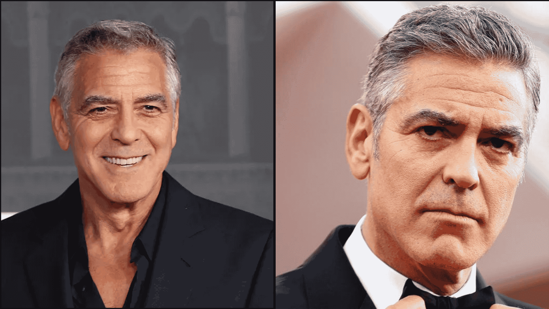 George Clooney before and after blepharoplasty comparison with a more open eye appearance