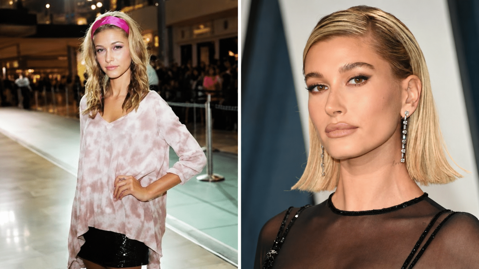 Hailey Bieber lip comparison showing refined upper lip shape and subtle celebrity lip lift appearance in recent years