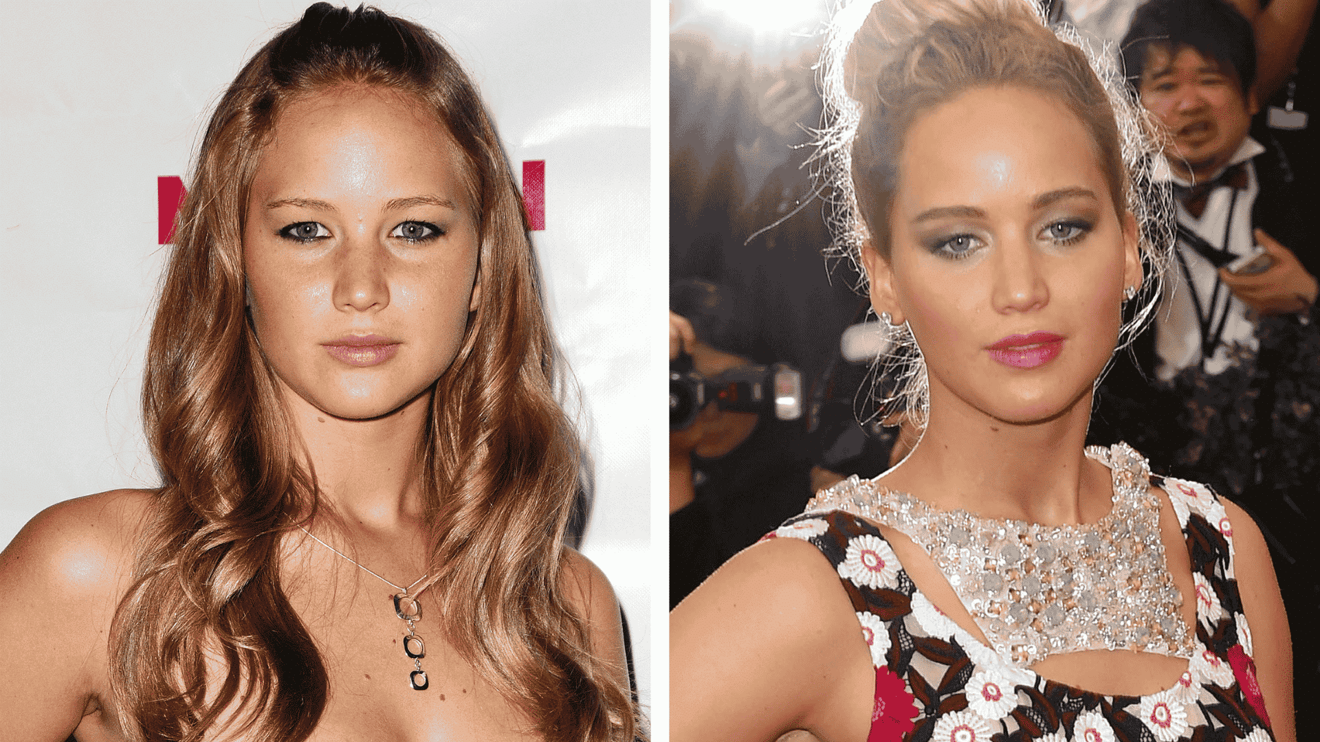 Jennifer Lawrence before and after blepharoplasty showing reduced under-eye puffiness