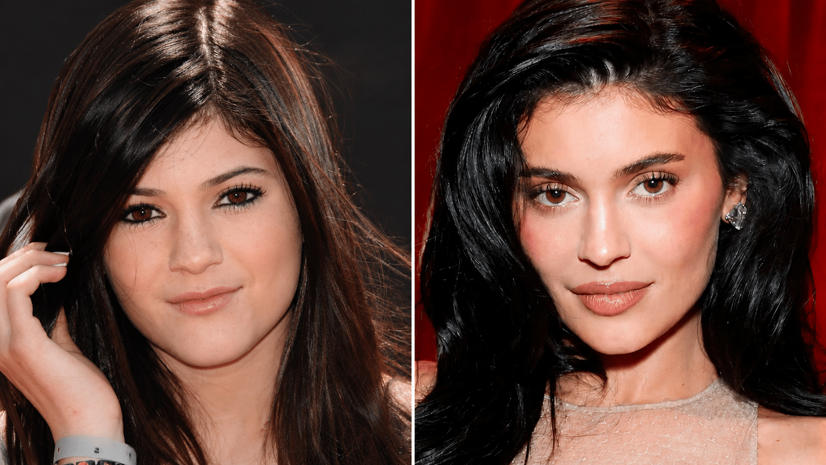 Kylie Jenner lip comparison showing subtle upper lip lift effect with more visible lip surface in recent appearance versus earlier photo