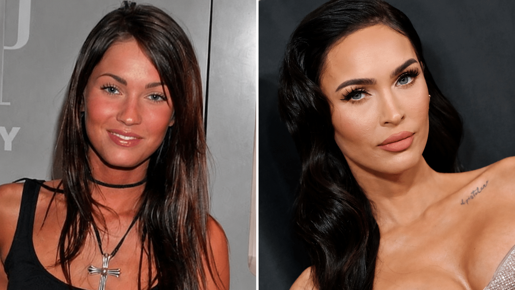 Megan Fox lips comparison highlighting naturally defined upper lip shape and subtle fullness change over time