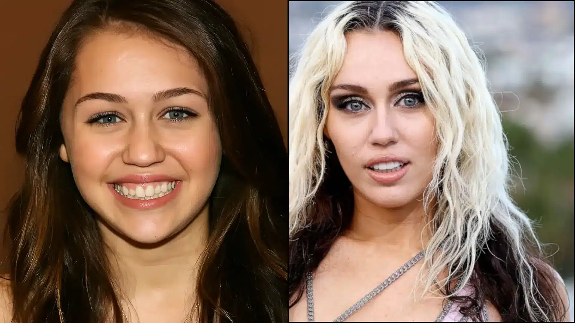 Side-by-side comparison of Miley Cyrus’s smile, showing her teeth transformation from slightly uneven and off-white during her early career to bright