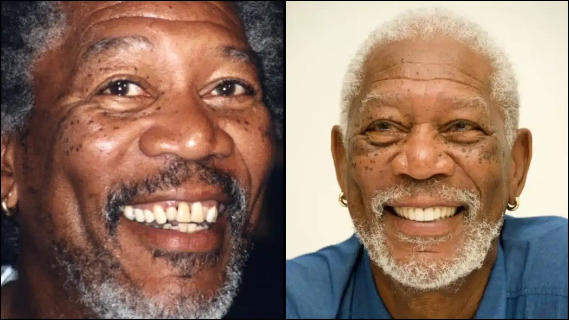 Close-up of Morgan Freeman’s smile showing straight, bright, and well-aligned teeth, highlighting a polished and natural appearance, possibly enhanced with cosmetic veneers.