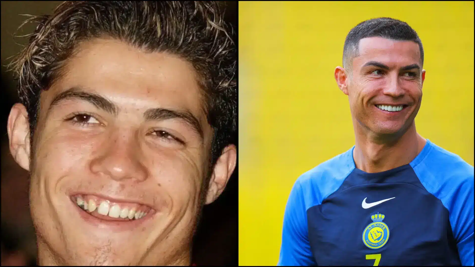 Close-up of Cristiano Ronaldo’s smile showing bright, straight, and symmetrical teeth, highlighting a polished, camera-ready appearance likely achieved with cosmetic veneers.