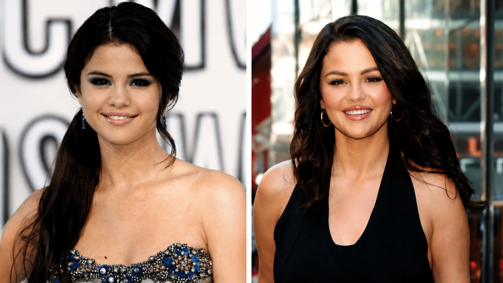 Selena Gomez lip comparison showing improved upper lip definition and softer, more balanced lip structure in recent appearance