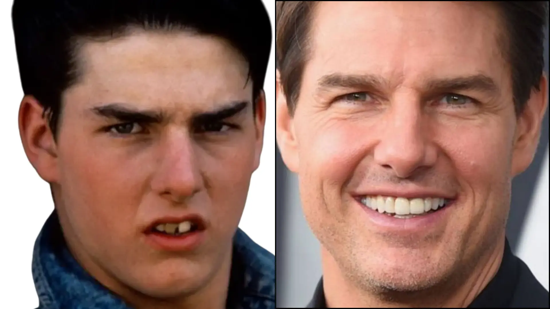 Side-by-side before and after comparison of tom cruize smile, showing teeth transformation from slightly uneven and off-white to bright, straight, and symmetrical.