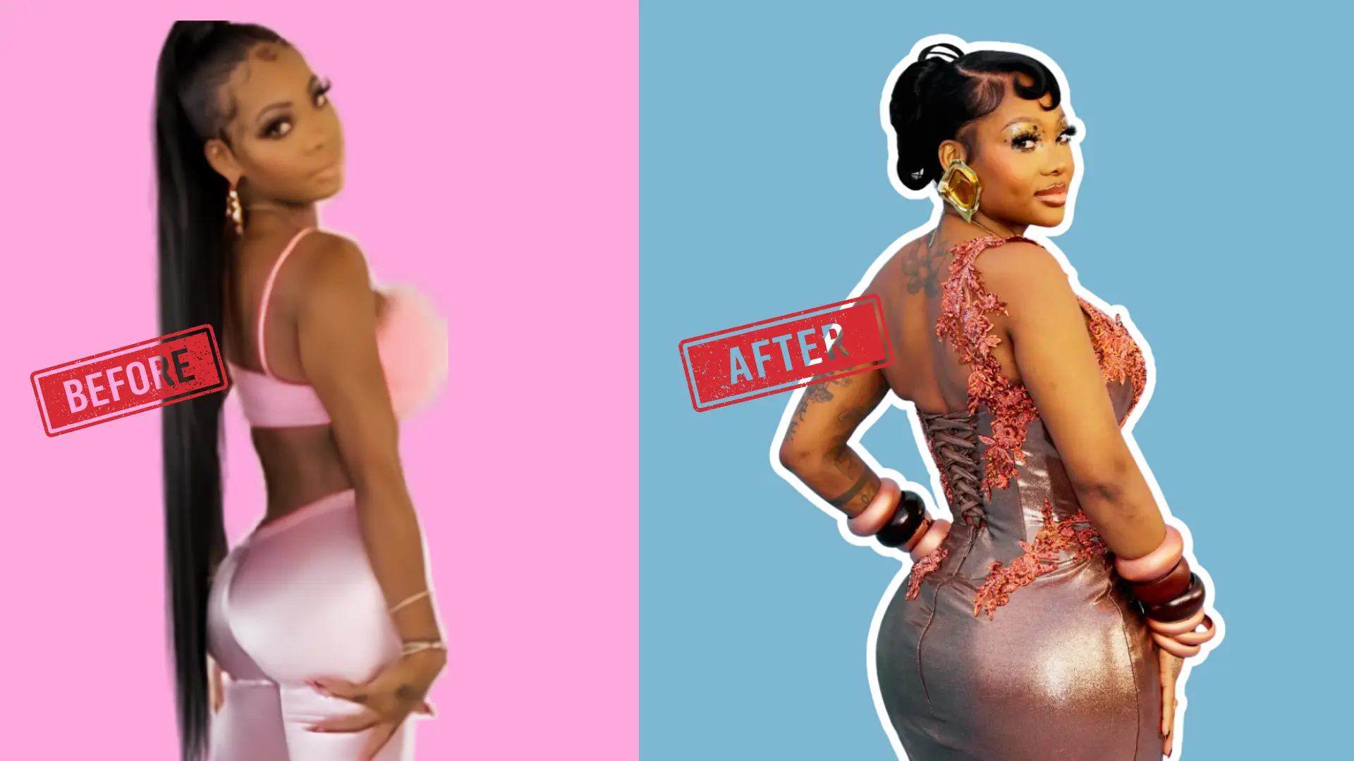 Summer Walker before and after butt injections, showing the visible difference in her figure from her own confirmed procedure.