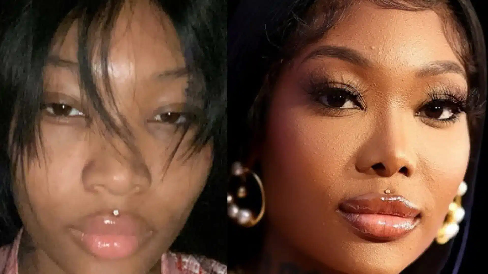 Side-by-side comparison of Summer Walker's nose before and after her confirmed rhinoplasty procedure.
