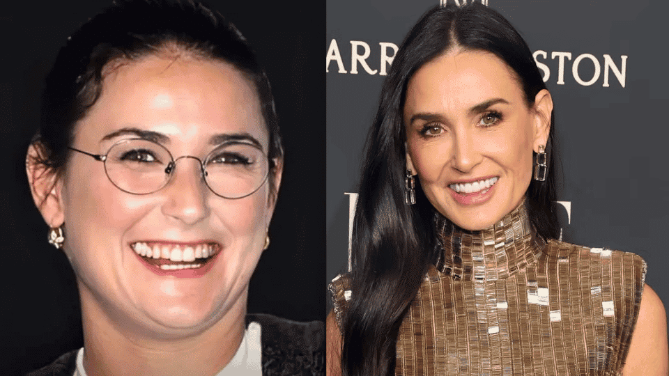 Before and after teeth transformation showing smile improvement, whitening, and enhanced dental appearance.