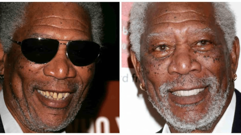 Morgan Freeman smiling, displaying his natural-looking before and after dental implant and veneer results.