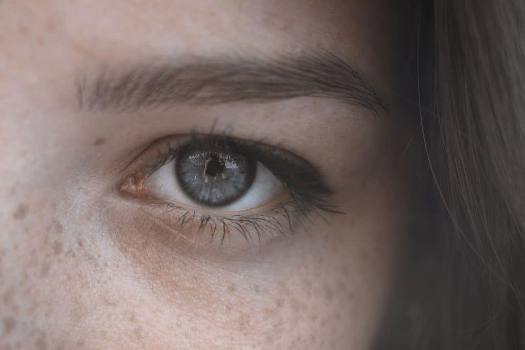 Pigmentation Removal Guide for Mom’s: Causes, Treatments, and Prevention