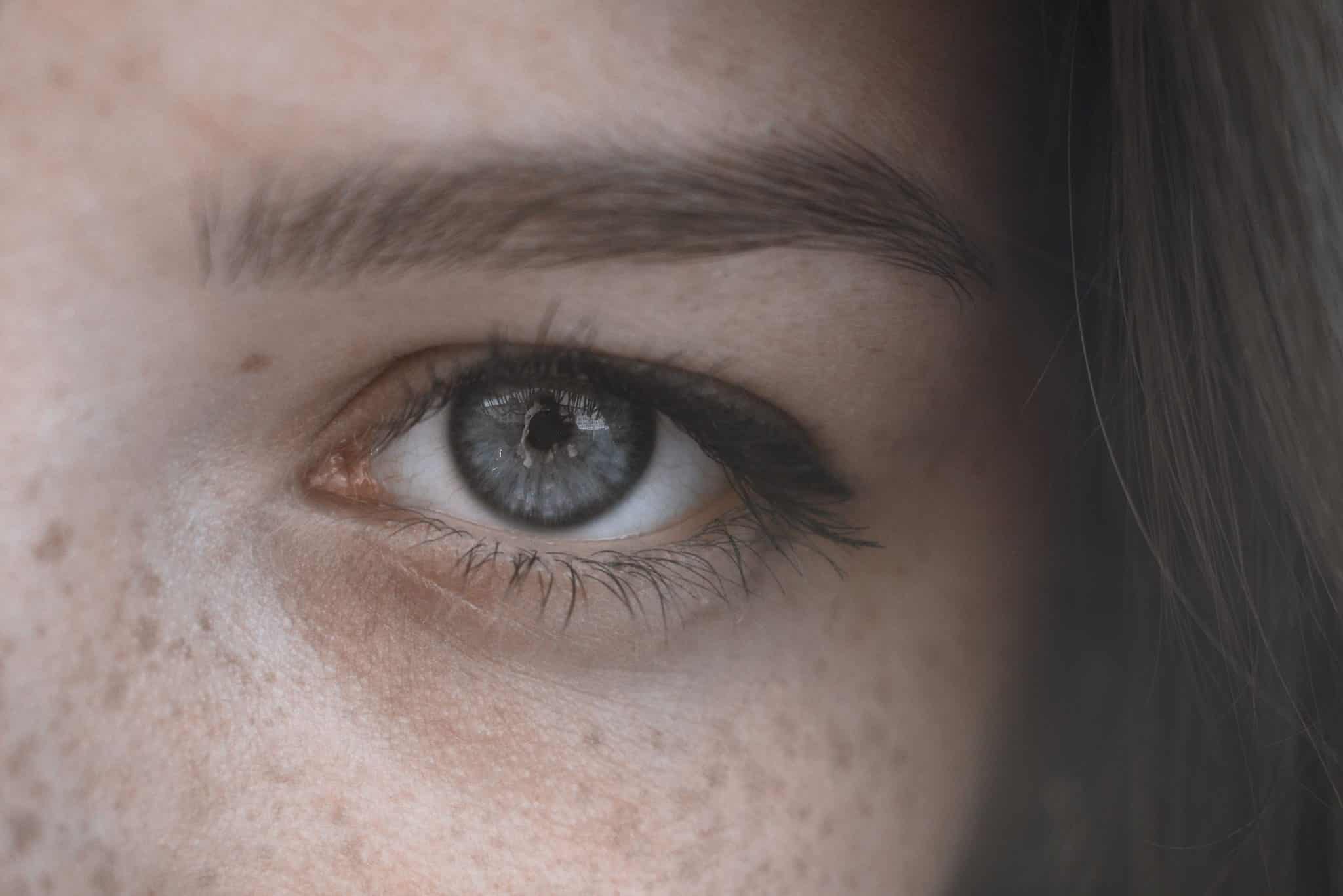 Pigmentation Removal Guide for Mom’s: Causes, Treatments, and Prevention